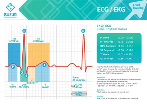 EKG Readings