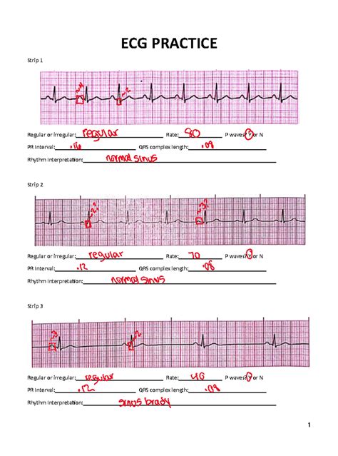 Ekg test