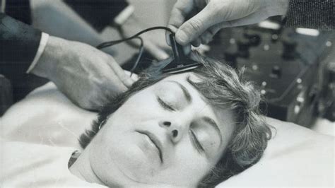 Electro Shock Therapy Future