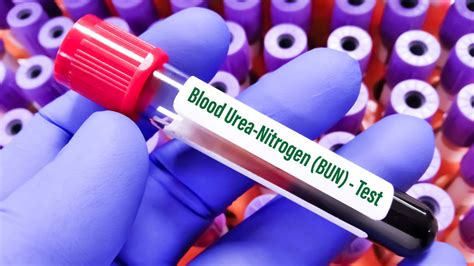 Elevated Nitrogen in Blood Levels