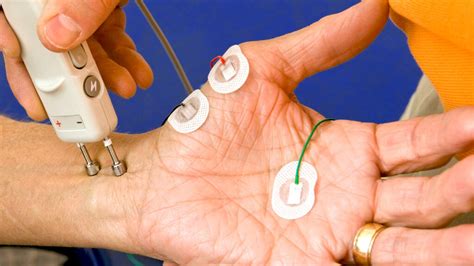 Preparation for EMG Test