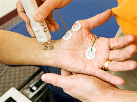 EMG test experience