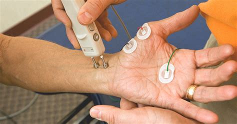 EMG test procedure