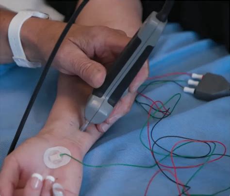 EMG test questions