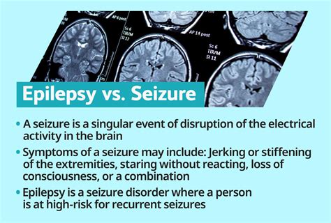 Epilepsy treatment