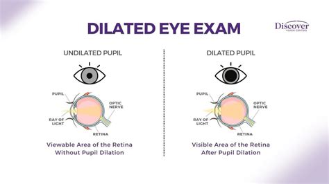 eye exam