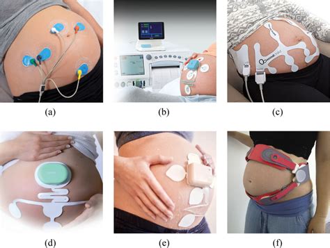 fetal monitoring