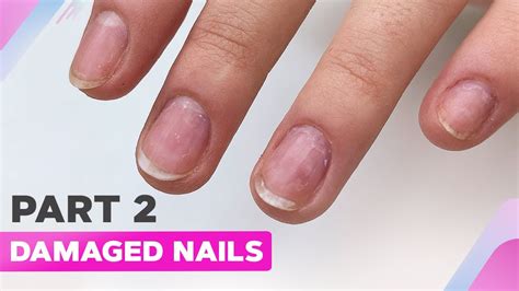 Fixing a damaged nail bed