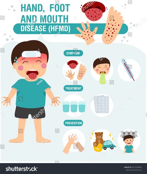 Symptoms of foot-and-mouth disease