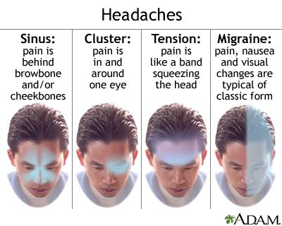 Forehead Headaches