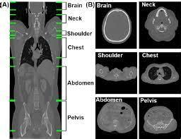 Full Body CT Scan Technology