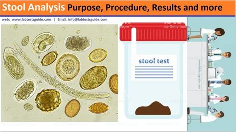 future developments stool sample tests