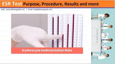 Future Directions for Sedimentation Rate Test