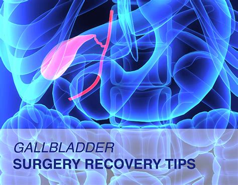 Gallbladder removal healing tips
