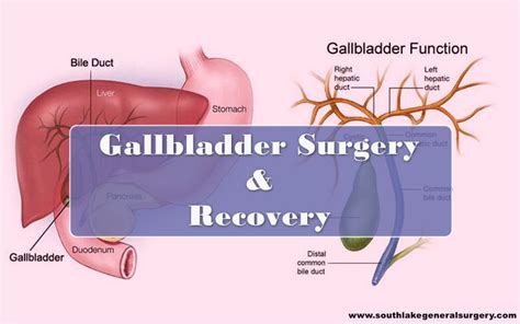 Gallbladder Surgery Recovery