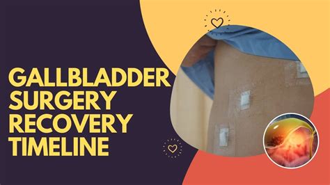 Gallbladder Surgery Recovery Timeline