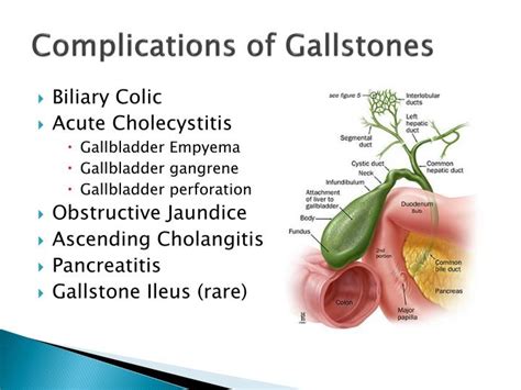gallstone complications