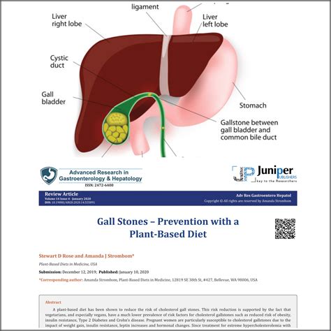 gallstone prevention