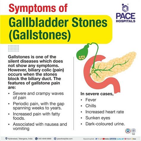 gallstone symptoms