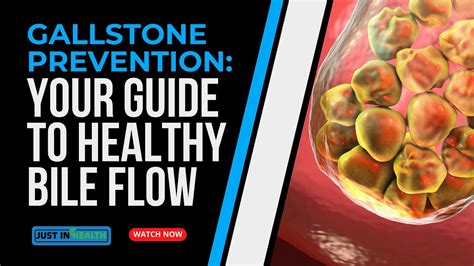 Gallstones Prevention