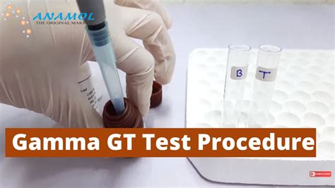 Gamma Gt Test