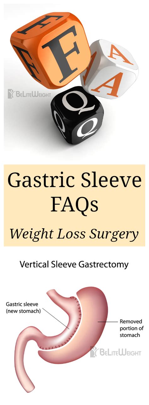 Gastric sleeve procedure FAQs