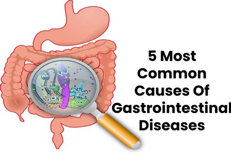 Gastrointestinal causes of spitting up blood