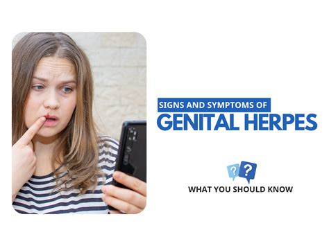 Genital Herpes Signs