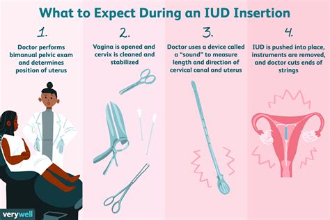 Getting an IUD Inserted