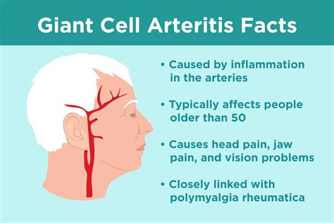 Giant Cell Arteritis Support