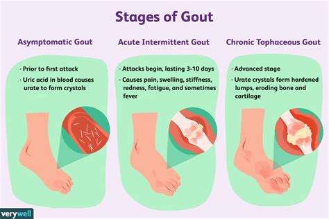 Gout and Other Health Conditions