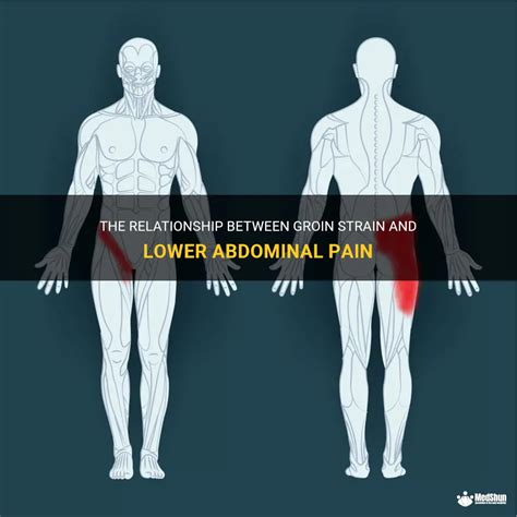 Groin Strain Causes