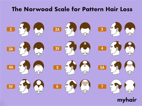 hair fall