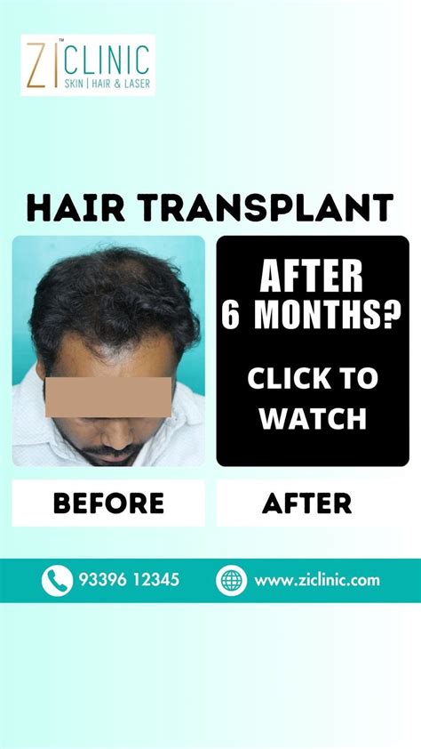 Hair growth process