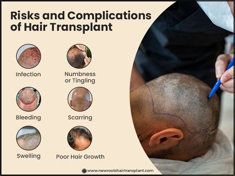 Hair Transplantation Risks and Complications