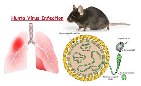 hantavirus image