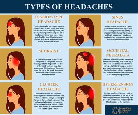 Headache Symptoms
