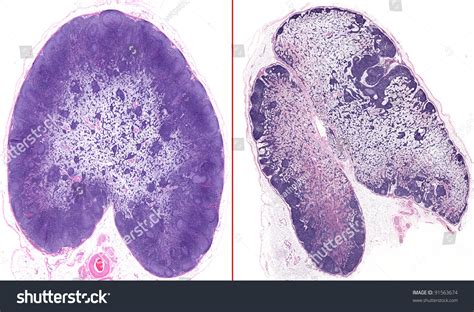healthy lymph nodes