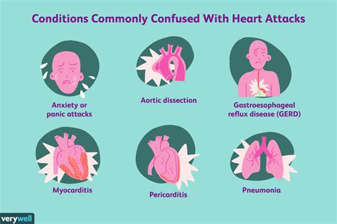 Heart Attack Diagnosis