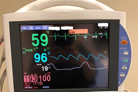 heart monitoring
