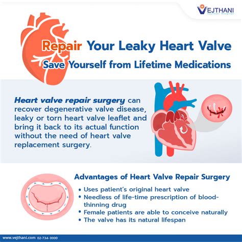 Benefits and Risks of Heart Valve Repair