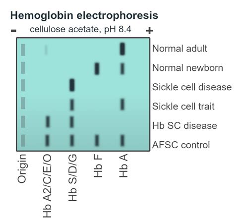 Hemoglobin Electrophoresis