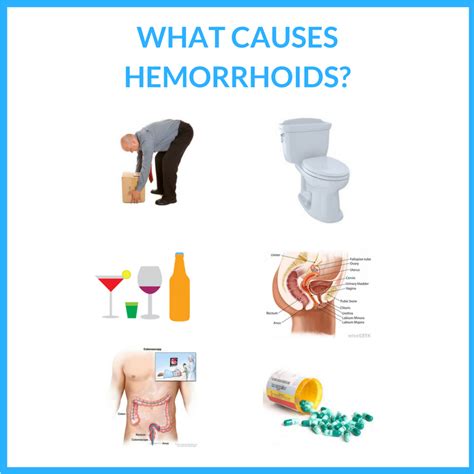 Cause of Hemorrhoids