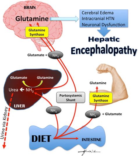 Hepatic encephalopathy management