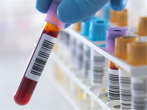 herpes blood test