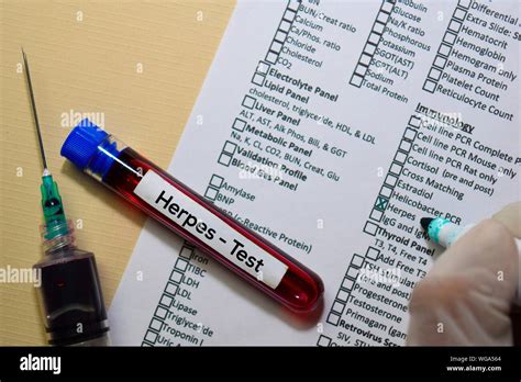 herpes blood test