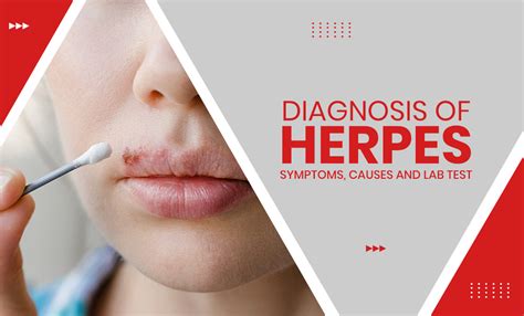 Herpes Diagnosis