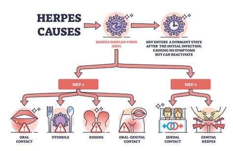 Herpes Infection Causes