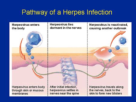 Herpes Infection Living