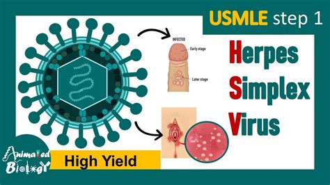 Herpes Infection Treatment